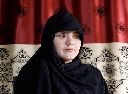Khatera teve os olhos arrancados por extremistas islâmicos 